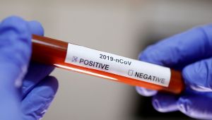 Coronavirüsten korunma yolları neler, ne yapmalı?