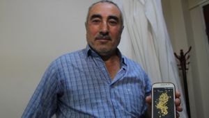 Mesanesinden nohut büyüklüğünde 199 taş çıktı!