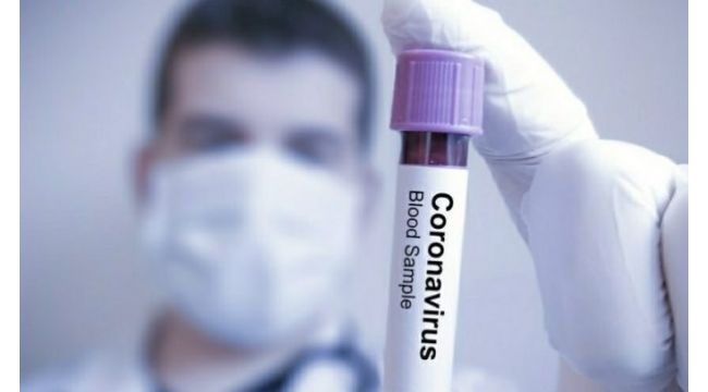 Koronavirüsten korunmanın yolu hijyen