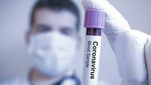 Koronavirüsten korunmanın yolu hijyen