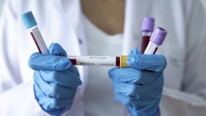 Ve başardık! Korona için yerli ilaç ve aşı tarihi verildi