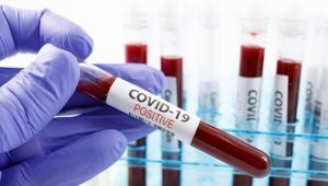 Gribim diyene koronavirüs testi yapılacak