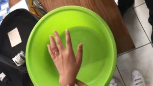 Küçük çocuğun parmağında sıkışan yüzüğü itfaiye ekipleri çıkarttı