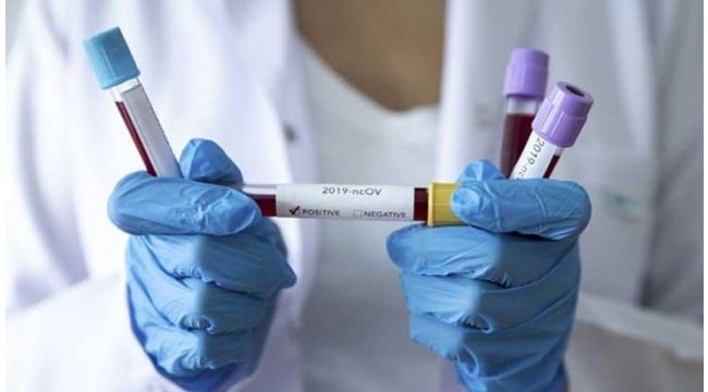 Kocaeli’de koronadan bir günde 53 kişi hastaneye yatırıldı!