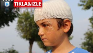 Kocaeli'de sokak ortasında kangal dehşeti