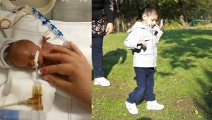 Parmak bebek olarak doğmuştu: Şimdi ne halde