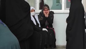 Ekmek tandırına düşüp yanan kadının kolu kesildi