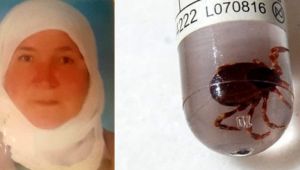 Bacağına yapışan keneyi çıkardı, hayatını kaybetti