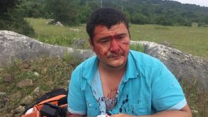Saldırıya uğrayan Gazeteci o anları anlattı!