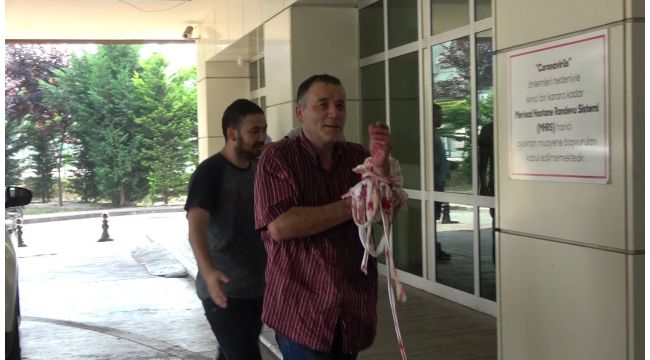 Acemi kasaplar hastanelik oldu