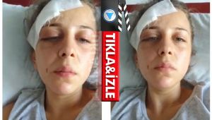 Eski eşinden gördüğü işkenceyi böyle anlattı