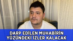 Darp edilen Muhabirin yüzündeki izler kalacak!