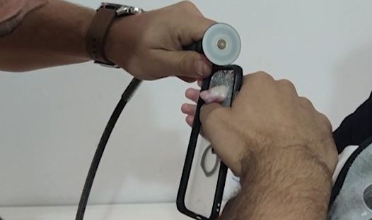 Minik bebeğin parmağı öyle bir yere sıkıştı ki gören şaşkına döndü