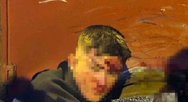 Kocaeli'de 2 motosiklet ve kamyonetin karıştığı kazada 4 kişi yaralandı