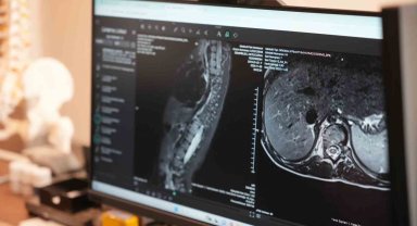 Sinsi ilerleyen bu rahatsızlığı ilk fark eden anneler oluyor