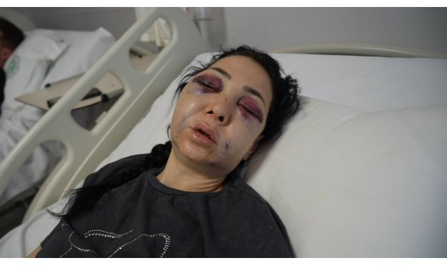 Anne ve oğlunun darp edilmesine ilişkin gözaltına alınan 3 şüpheliden 1'i tutuklandı