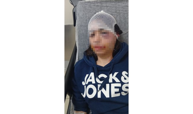 Ayrılık kararını kabullenemeyip kız arkadaşını darbeden sanık: "Çok üzgünüm"